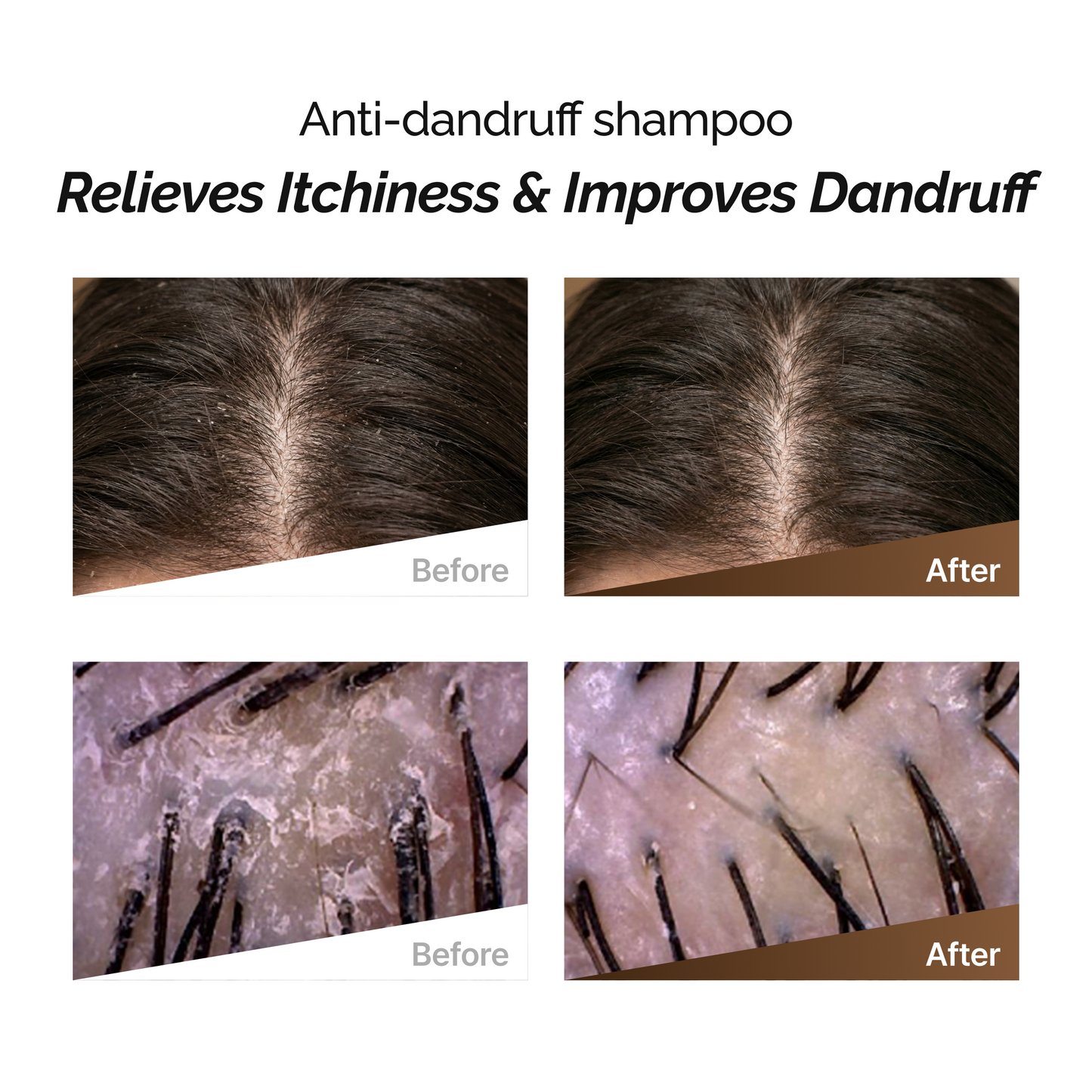 ROOTONIX Anti-Dandruff Shampoo 500ml