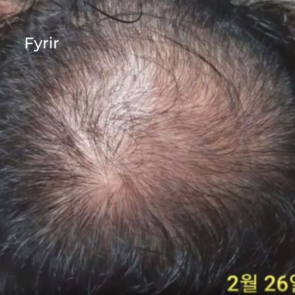 ROOTONIX ROOTFARM SCALP & ROOT