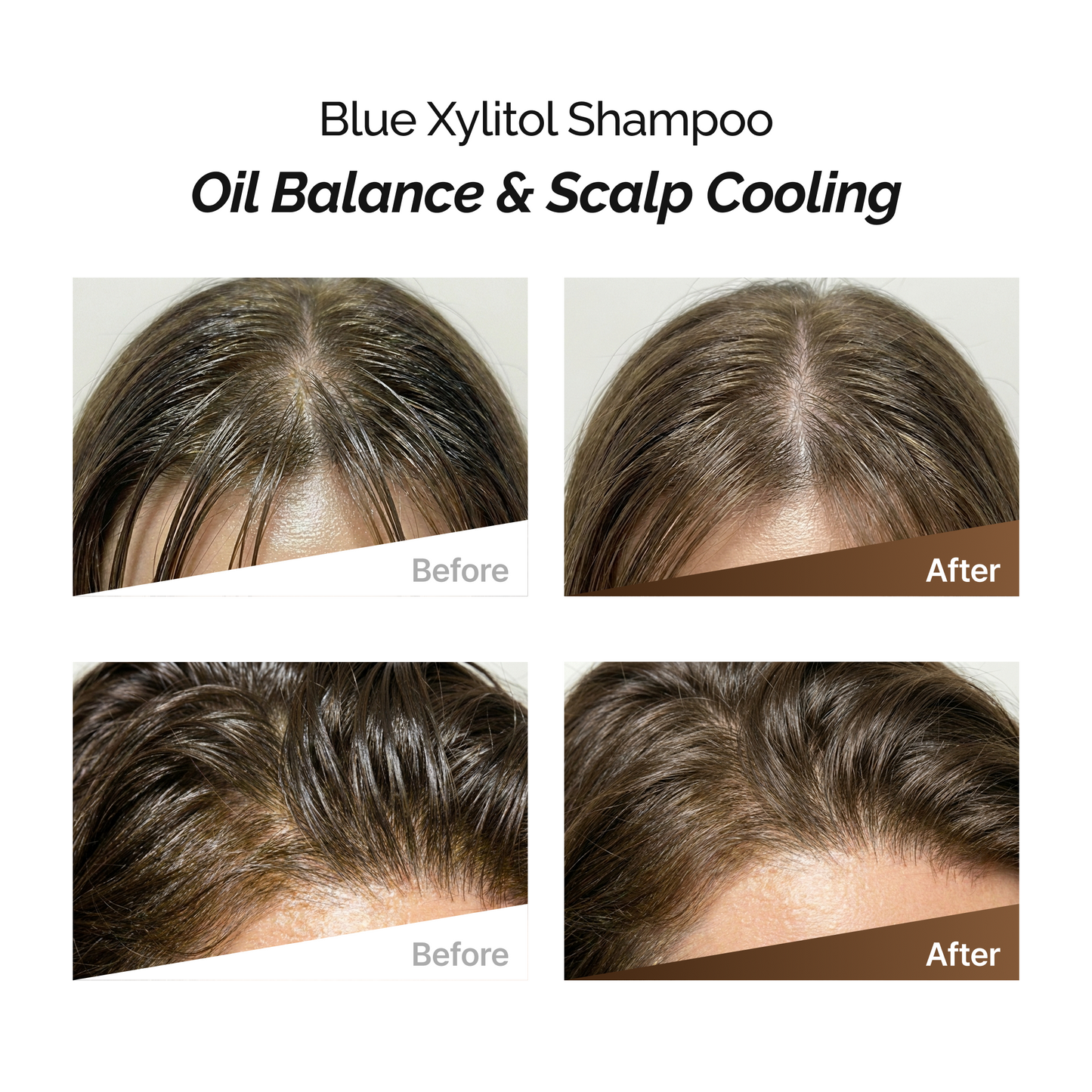 ROOTONIX Blue Xylitol Shampoo 500ml